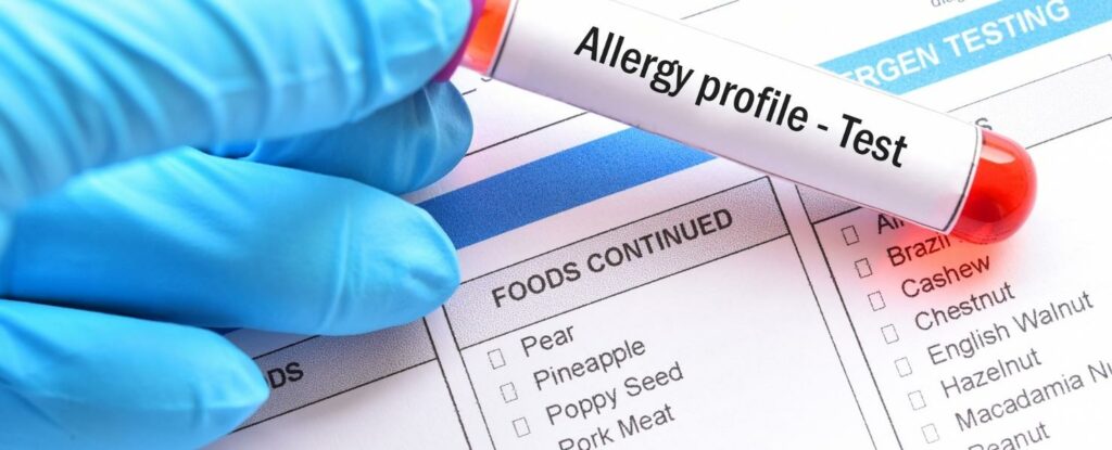 mention allergies when managing medications