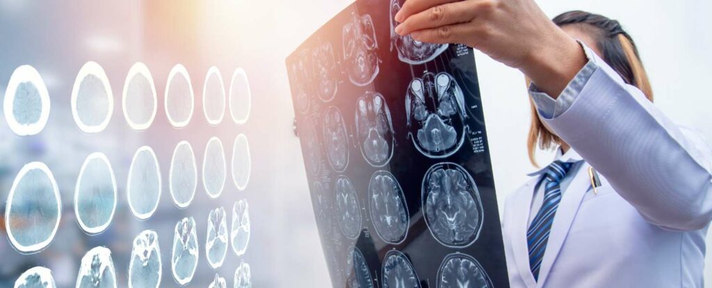 doctor examining xrays of a brain to determine stroke recovery plan